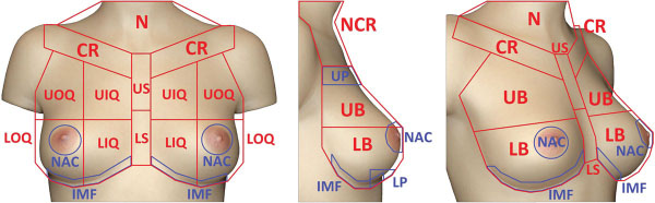 Analysis of the Visual Perception of Female Breast Aesthetic... : Plastic and Reconstructive Surgery
